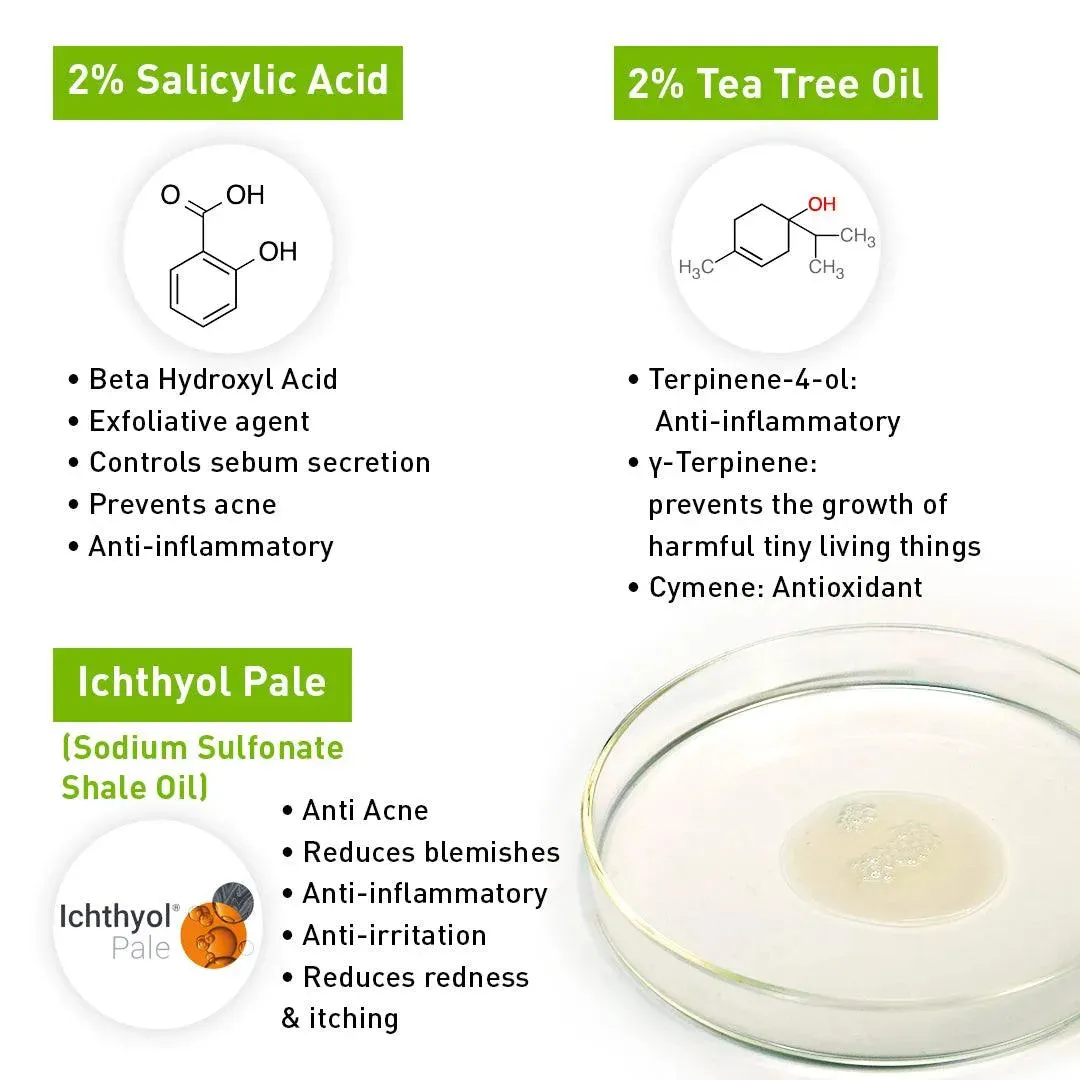 2% Salicylic Acid Tea Tree Serum, BHA   Terpineol, Acne, Blemishes, Blackheads, Whiteheads & Open Pores, Ichthyol Pale, Hyaluronic Acid, Vitamin E B5