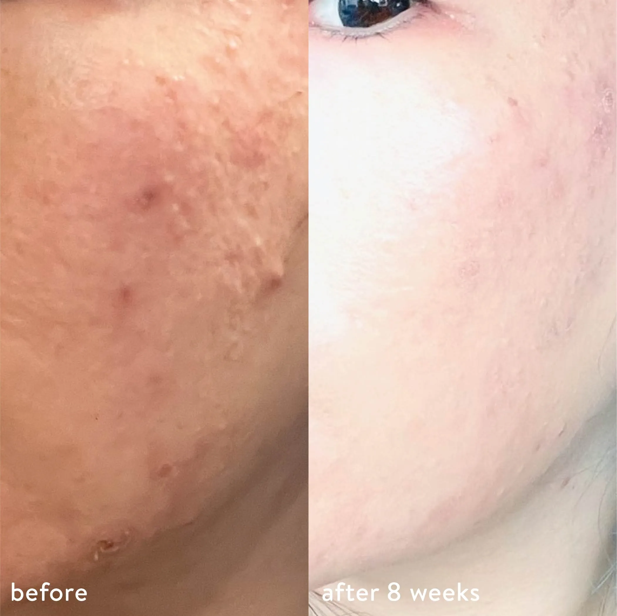 Save My Skin Serum